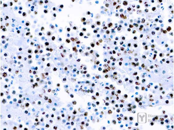 Immunohistochemistry of Rat Anti-Herpesvirus 8 Antibody