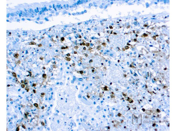 Immunohistochemistry of Mouse Anti-Herpes Simplex Virus Type II (HSV2) Antibody