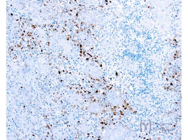 Immunohistochemistry of Rabbit Anti-Herpes Simplex Virus Type I (HSV1) Antibody