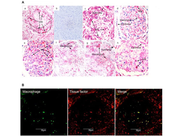 Histologic assay using streptavidin rhodamine