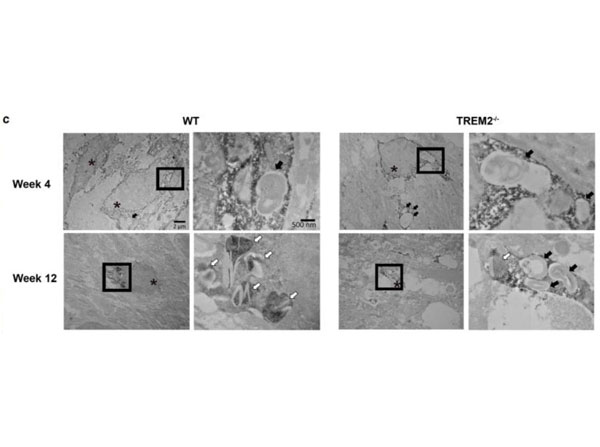 Immuno-electron microscopy using streptavidin-HRP