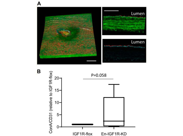 Microscopy using Streptavidin ATTO 647N
