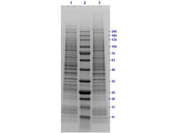 SDS PAGE Results of MOLT-4 Whole Cell Lysate