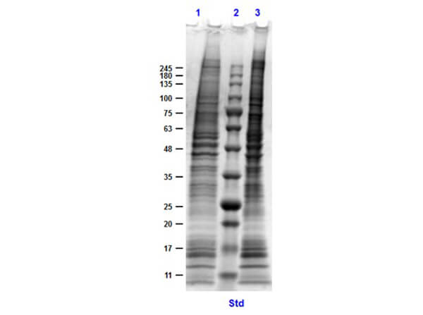 SDS PAGE Results of MDA-MB-231 Whole Cell Lysate