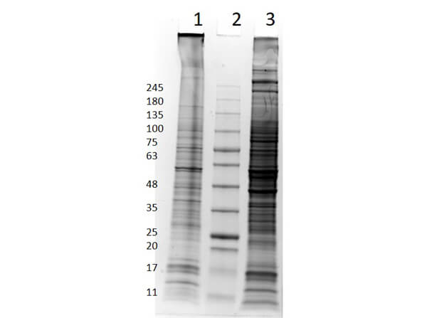 SDS-PAGE Results of A-172 Whole Cell Lysate