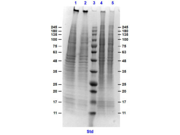 SDS-PAGE of HEK293 Whole Cell Lysate MG-132 Stimulated