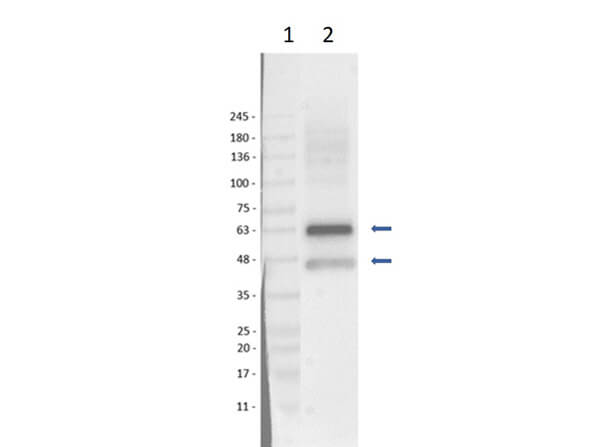 Western Blot Results of Rabbit Anti-SQSTM1/p62 Antibody using U-87 MG Lysate