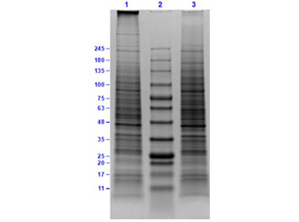 SDS-PAGE results of Daudi Whole Cell Lysate