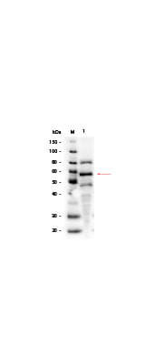 NIH/3T3 Whole Cell Lysate PDGF Stimulated - Western Blot
