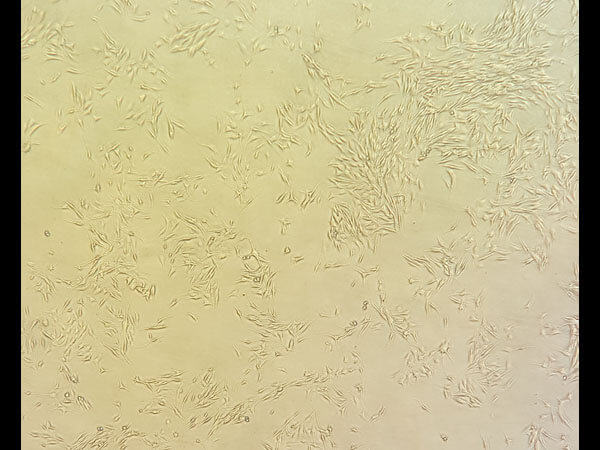 WM3311 viable cells