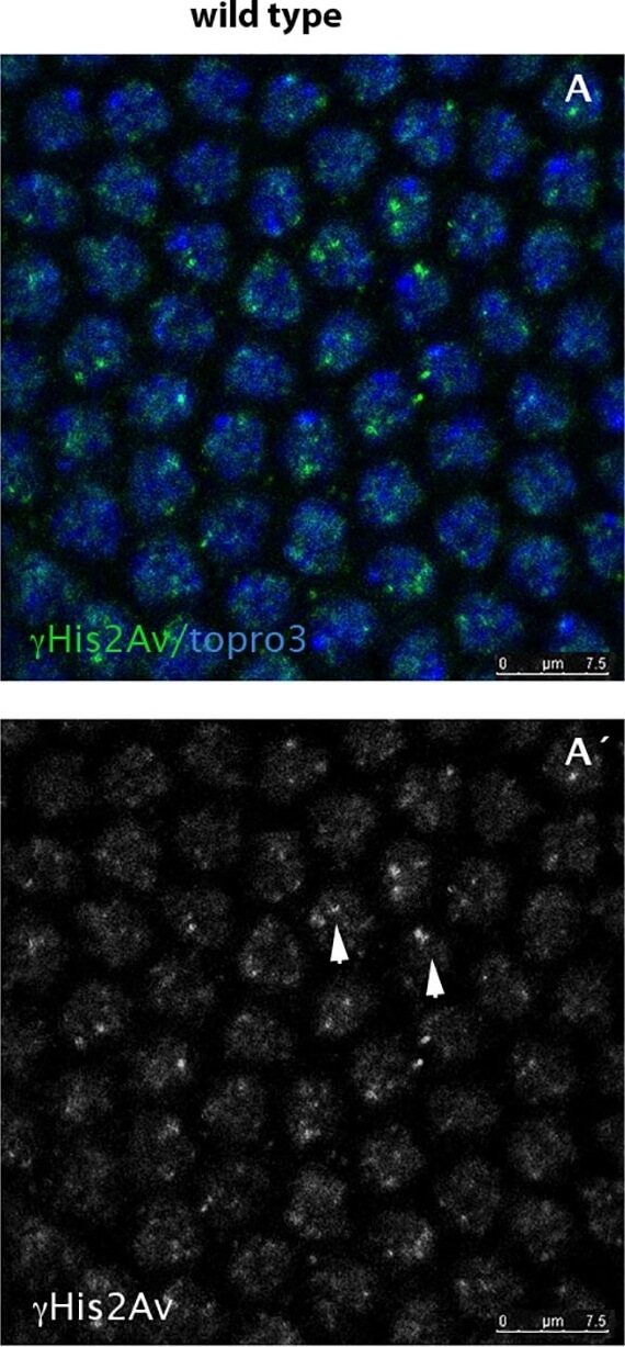 Immunohistochemistry of Anti-Histone H2AvD pS137