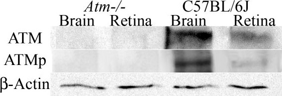 Western Blot of Mouse Anti-ATM pS 1981