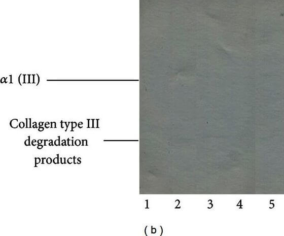 Western Blot of Anti-Collagen Type III